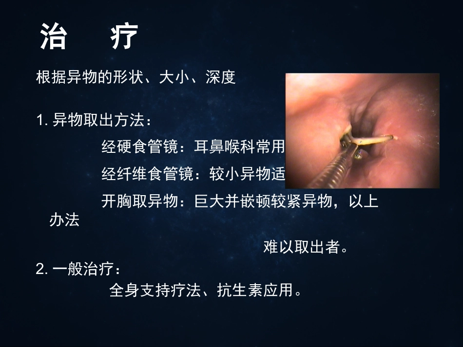 《食管疾病》ppt课件_第13页