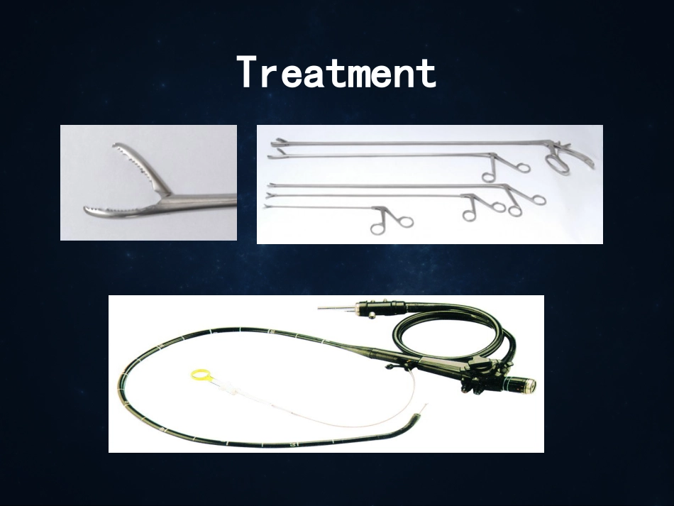 《食管疾病》ppt课件_第14页
