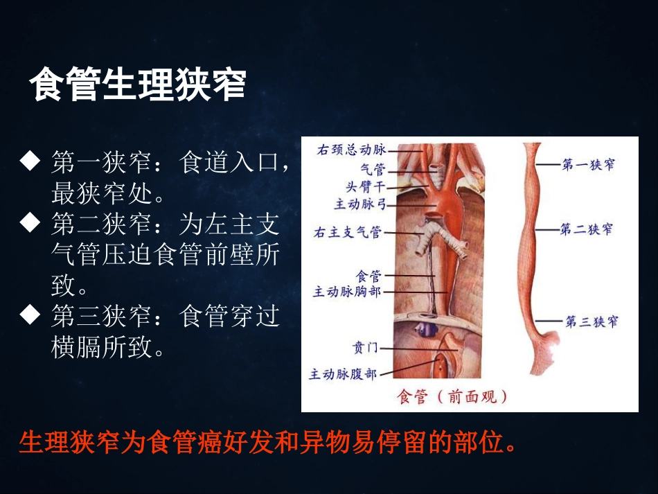 《食管疾病》ppt课件_第6页