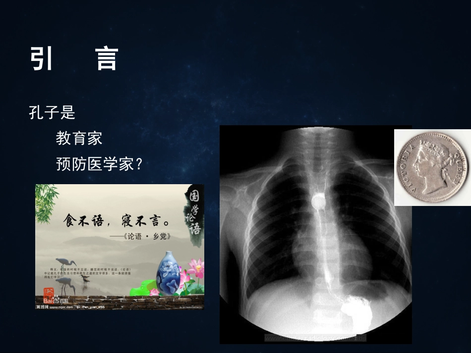 《食管疾病》ppt课件_第8页