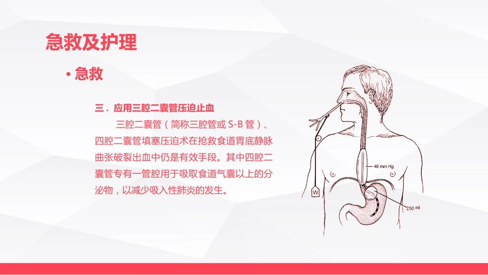消化道大出血的急救与护理_第14页