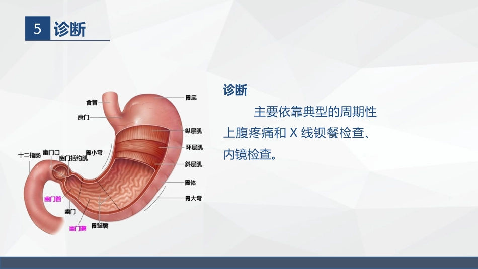 胃溃疡的业务学习_第10页
