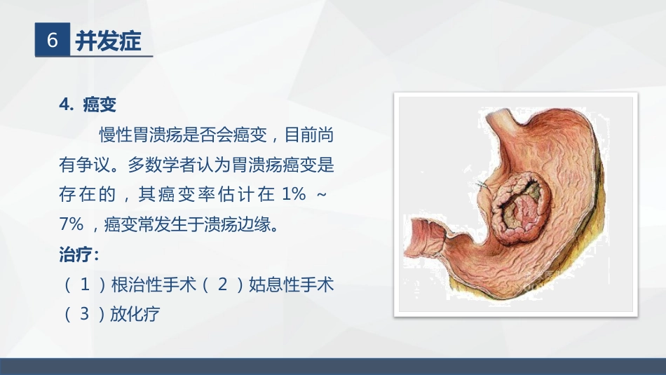 胃溃疡的业务学习_第14页