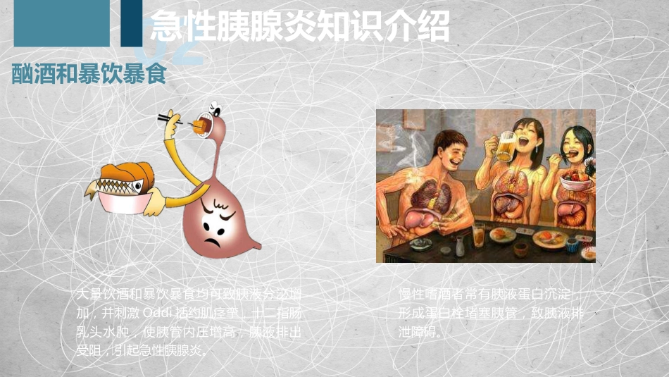 急性胰腺炎护理查房-2_第12页