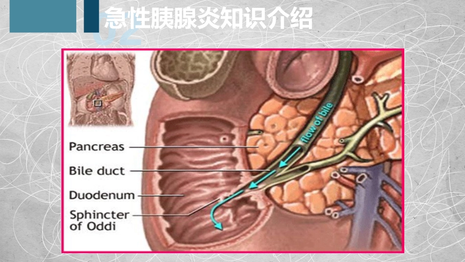 急性胰腺炎护理查房-2_第14页