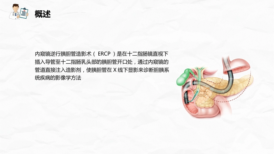 ERCP护理业务课件_第4页