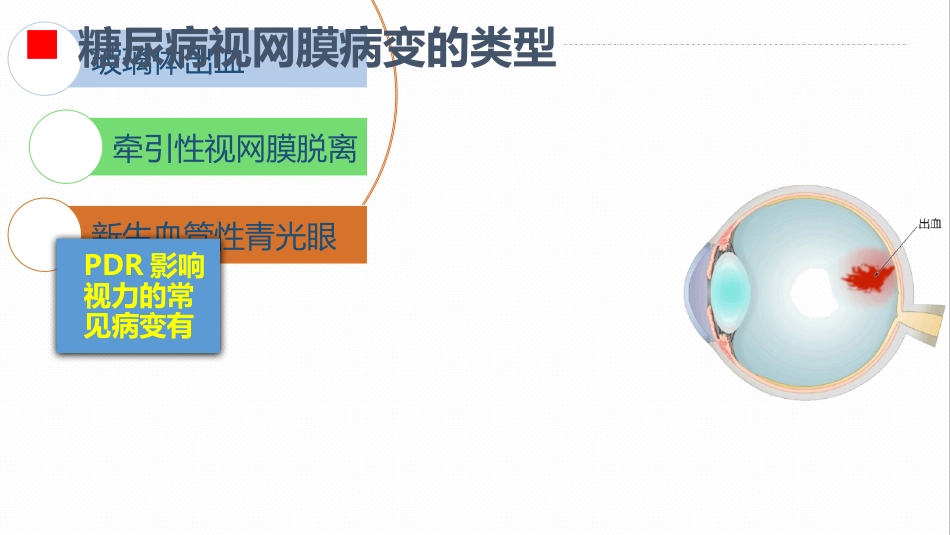 内分泌科-糖尿病视网膜病变患者护理查房_第10页