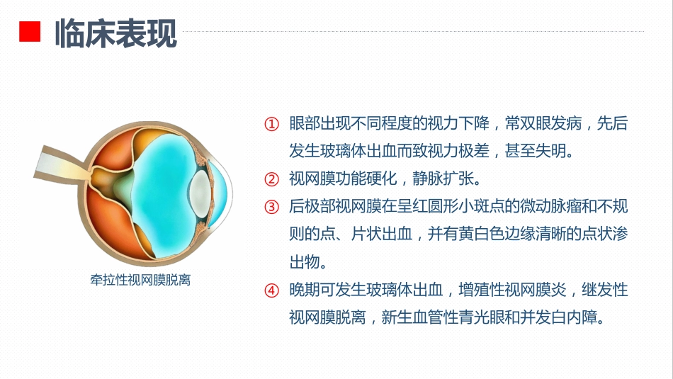 内分泌科-糖尿病视网膜病变患者护理查房_第11页