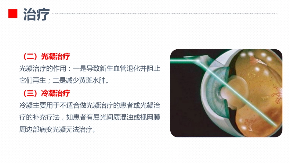 内分泌科-糖尿病视网膜病变患者护理查房_第14页