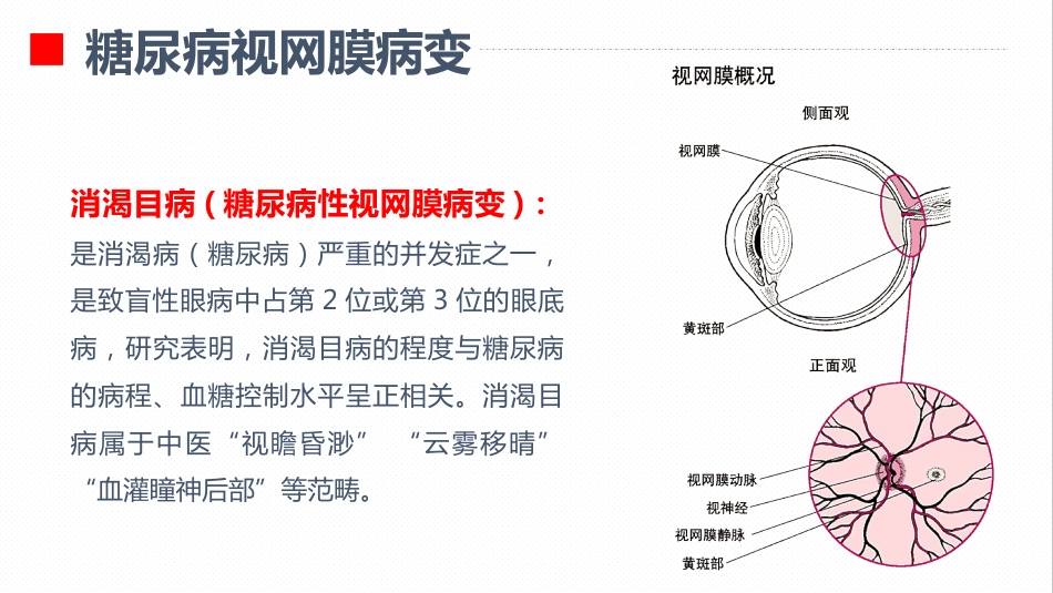 内分泌科-糖尿病视网膜病变患者护理查房_第4页