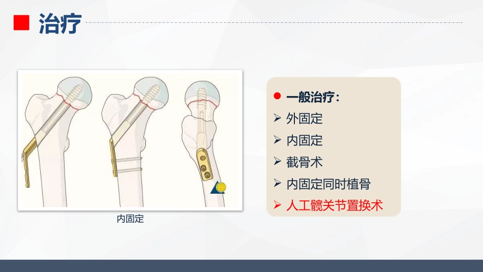 内分泌科-糖尿病的护理查房_第12页
