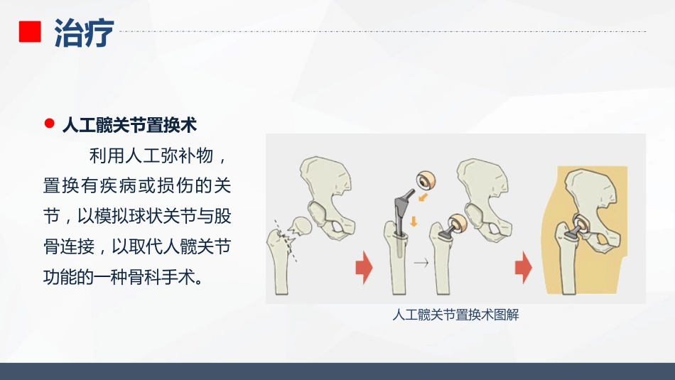内分泌科-糖尿病的护理查房_第13页