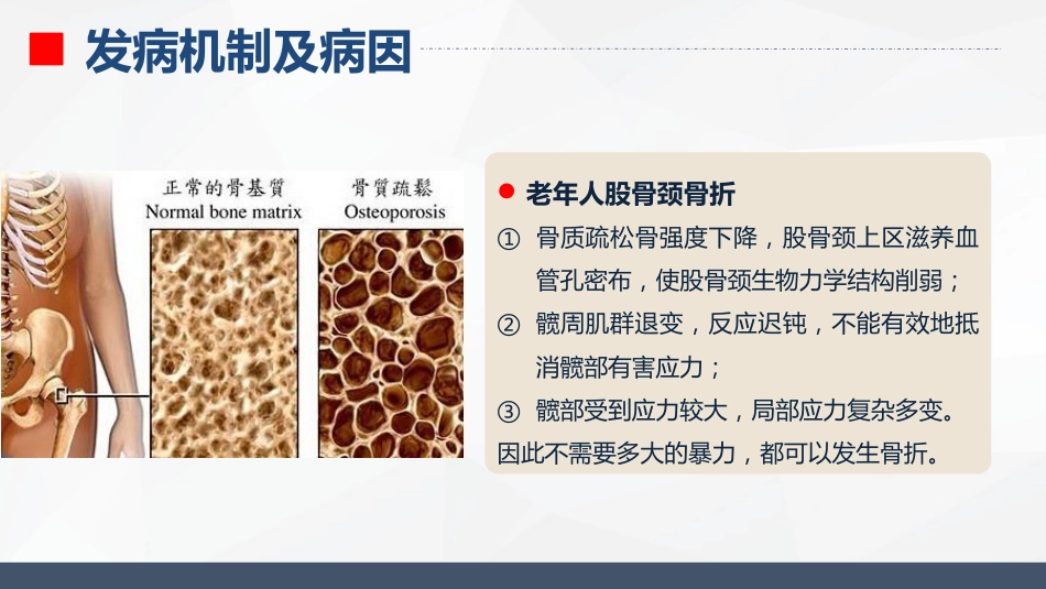 内分泌科-糖尿病的护理查房_第6页