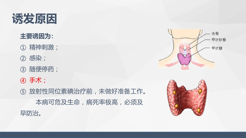 甲状腺危象的观察及护理_第5页