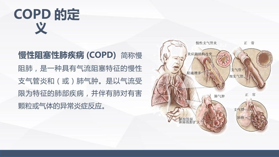 慢性阻塞性肺疾病(COPD)引起呼吸衰竭的业务学习_第4页