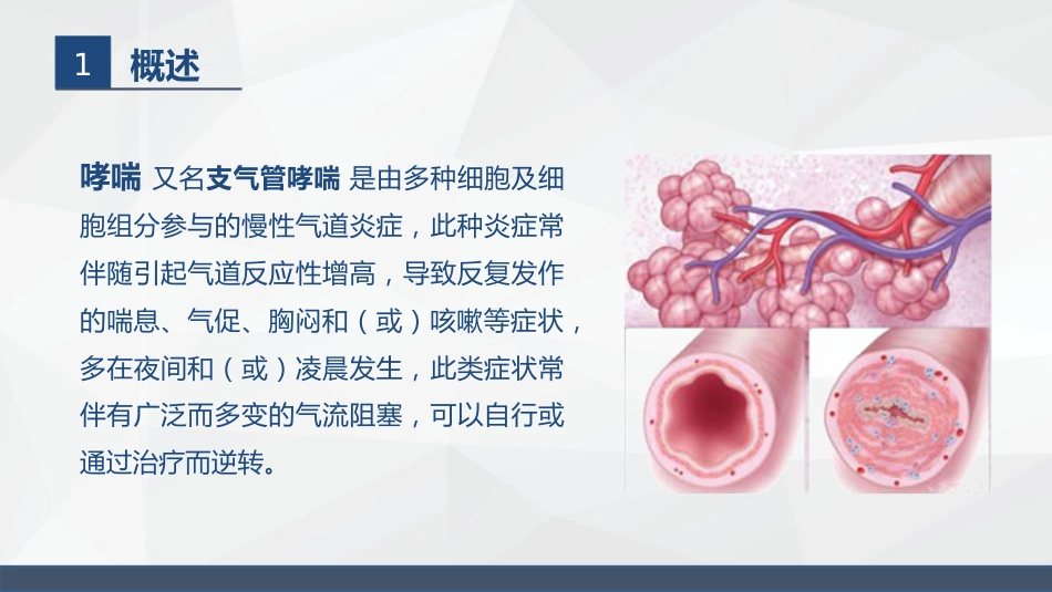 呼吸系统常见疾病的护理业务学习_第4页