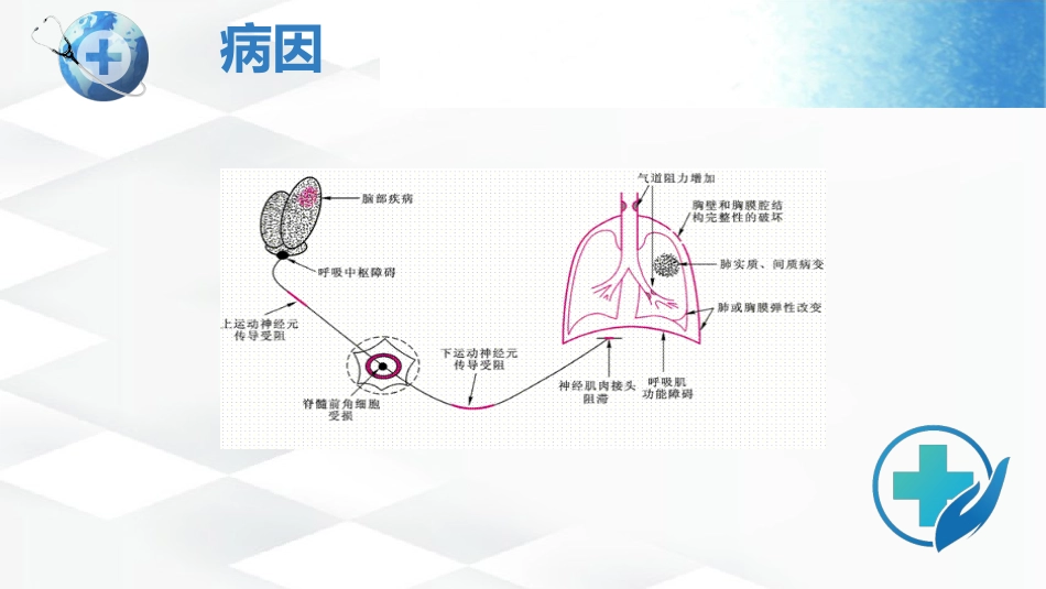 呼吸衰竭护理查房-2_第12页