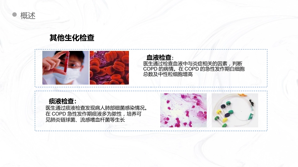 COPD慢阻肺病人护理查房_第13页
