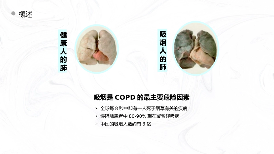 COPD慢阻肺病人护理查房_第6页