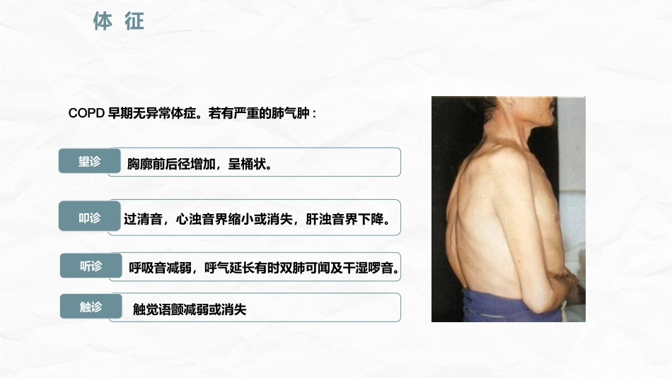 COPD护理查房_第7页