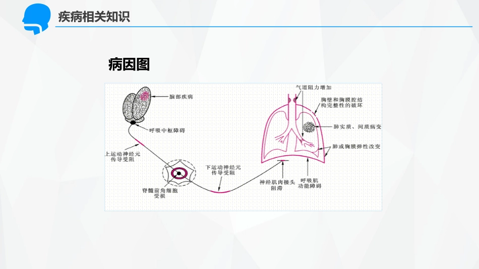 呼吸内科-呼吸衰竭护理查房 (2)_第12页