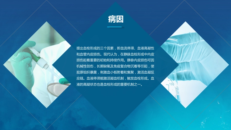 呼吸内科-肺栓塞病人护理 (2)_第14页