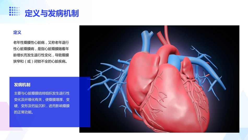老年性瓣膜性心脏病_第4页