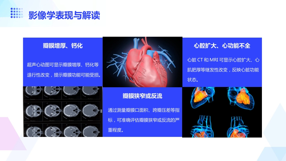 老年心脏瓣膜病_第11页
