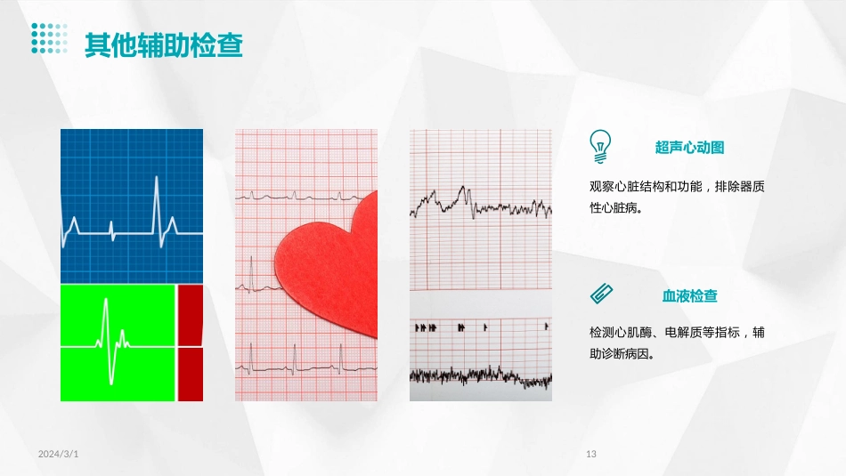 2024年室性早搏的诊断与治疗(PPT)_第13页
