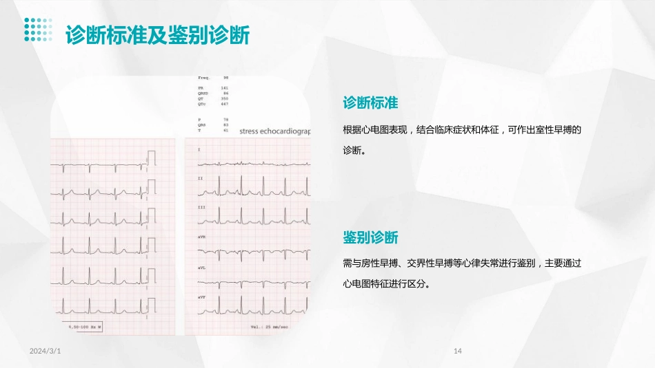 2024年室性早搏的诊断与治疗(PPT)_第14页