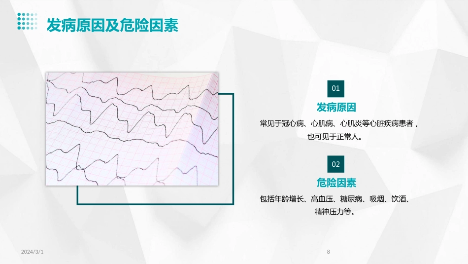 2024年室性早搏的诊断与治疗(PPT)_第8页