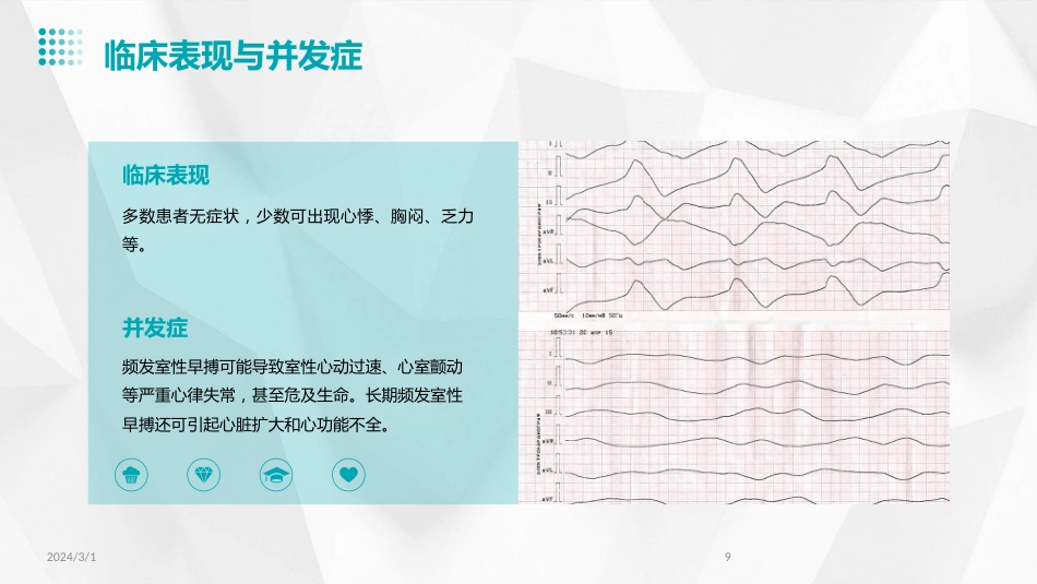 2024年室性早搏的诊断与治疗(PPT)_第9页