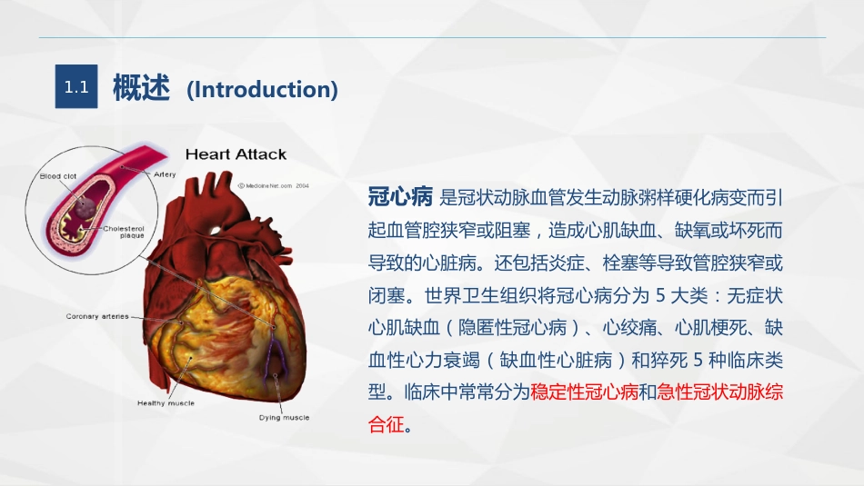 心血管内科-冠心病病人的护理查房_第4页