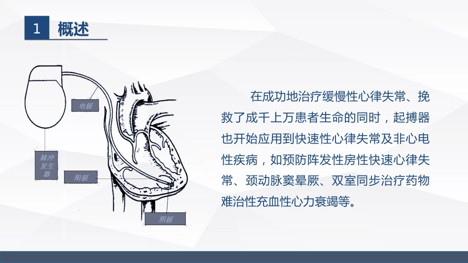 永久起搏器的业务学习_第5页