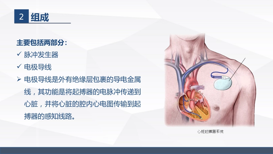 永久起搏器的业务学习_第6页
