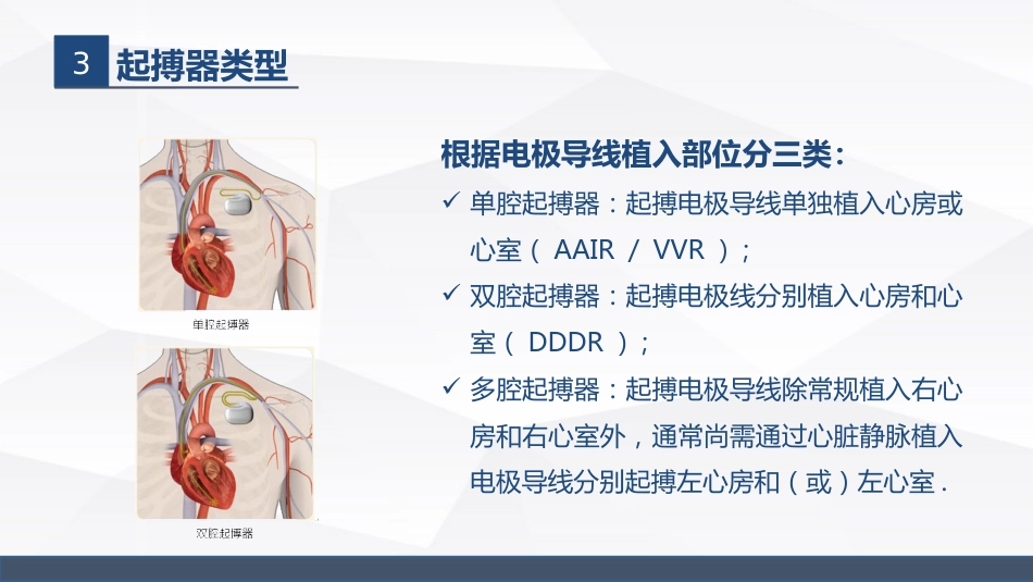 永久起搏器的业务学习_第7页
