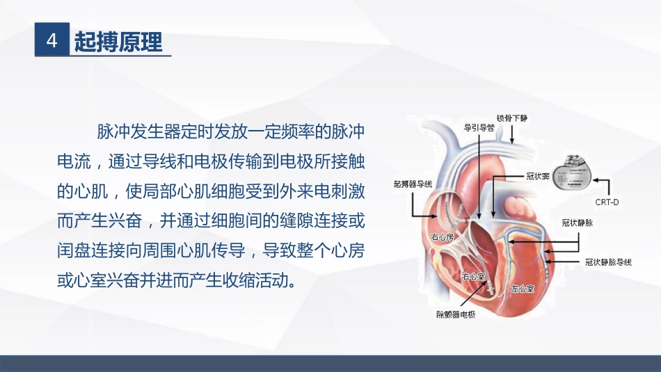 永久起搏器的业务学习_第8页