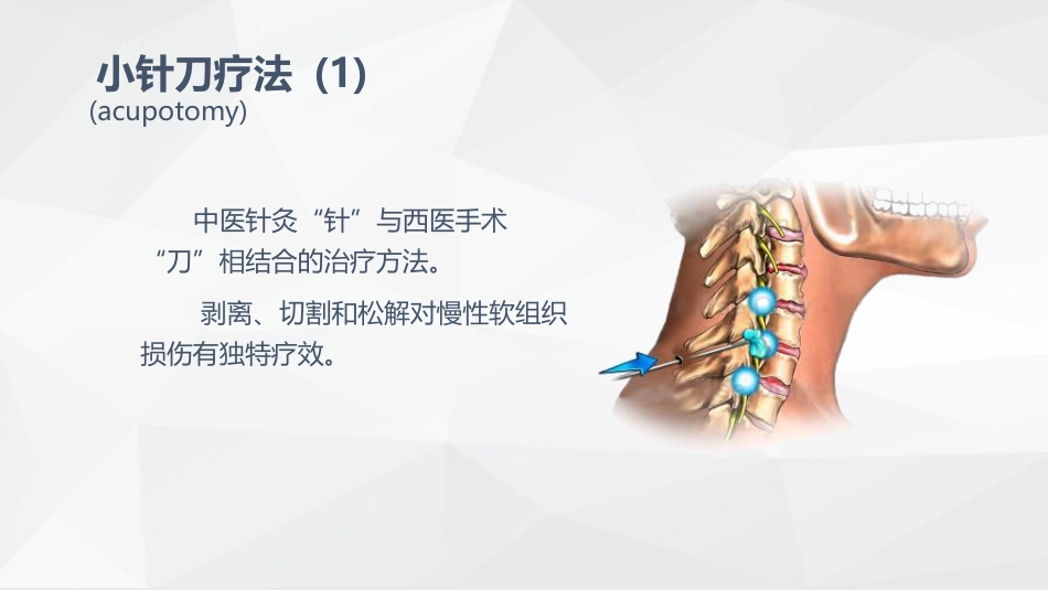 疼痛科常规治疗方法_第12页