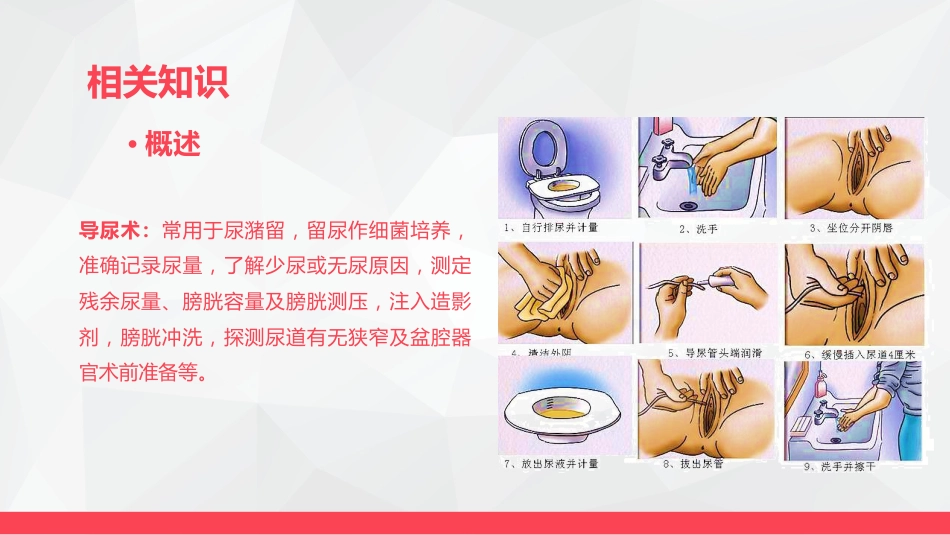 导尿术与灌肠法操作的并发症及处理_第4页