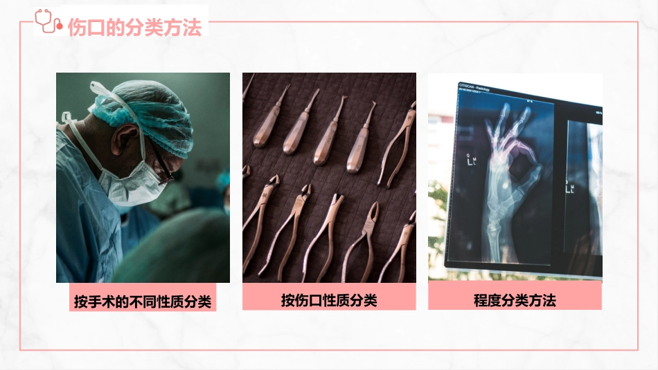 伤口护理_第14页