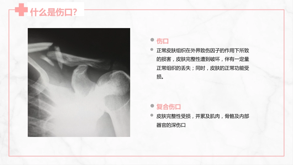伤口护理_第4页