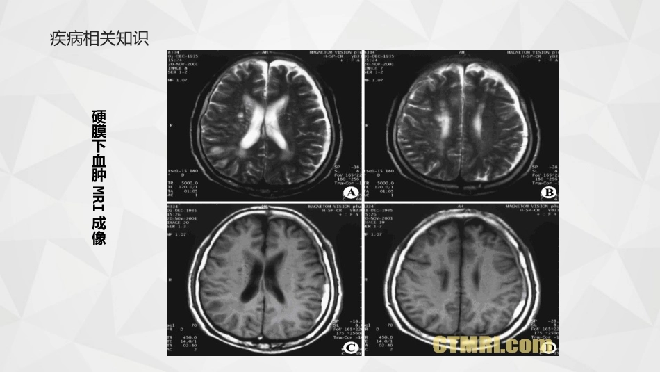 综合-护理查房综合通用-21_第13页
