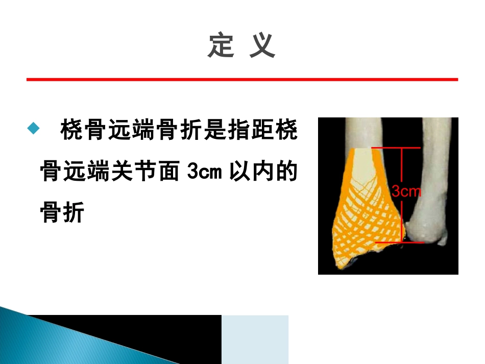 创伤中心：桡骨远端骨折课件_第3页