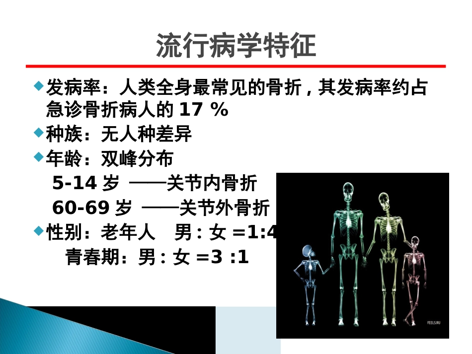 创伤中心：桡骨远端骨折课件_第4页
