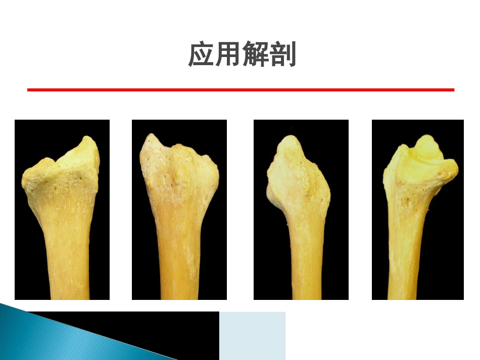 创伤中心：桡骨远端骨折课件_第5页