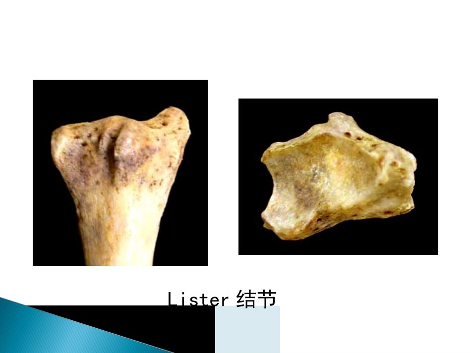 创伤中心：桡骨远端骨折课件_第6页
