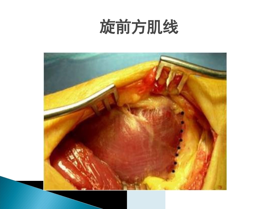 创伤中心：桡骨远端骨折课件_第9页