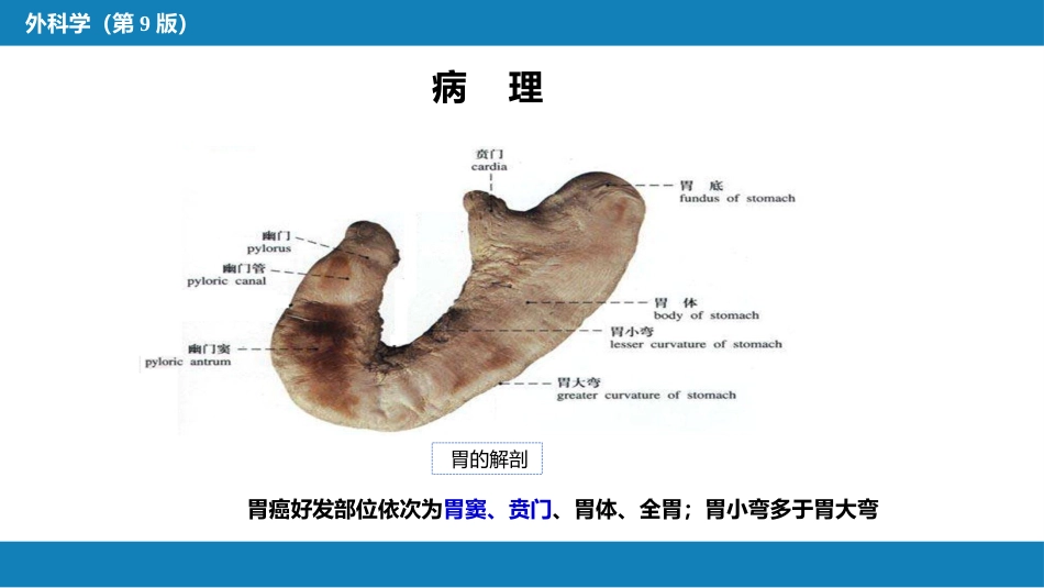 胃十二指肠疾病 第三节（一）胃癌_第7页