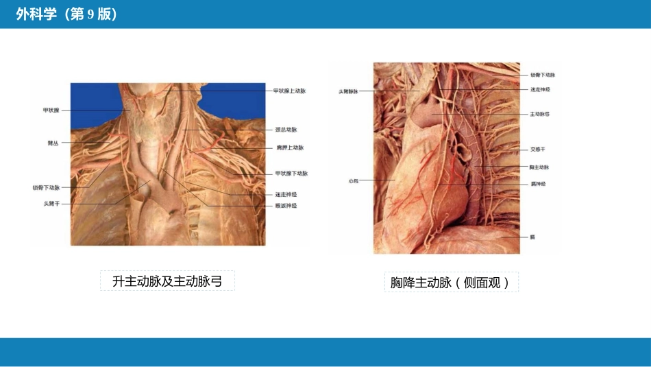 外科学：胸主动脉疾病_第6页