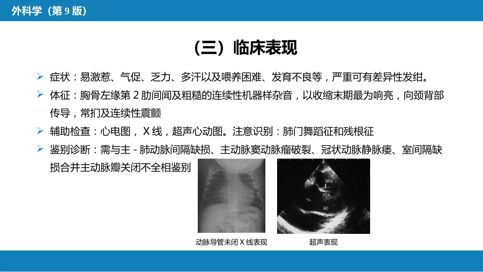 外科学：心脏疾病第二节先天性心脏病的外科治疗_第9页